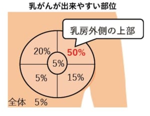 乳がんが出来やすい部位